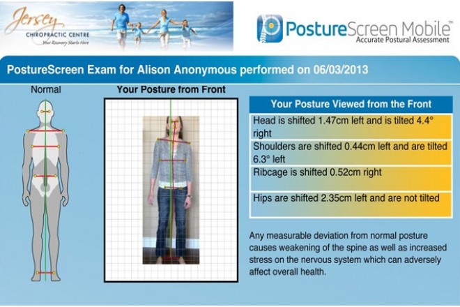 Posture Assesment – Front