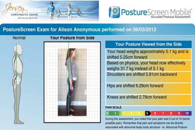 Posture Assesment – Side